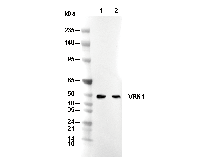 VRK1 Antibody [L11L3] WB