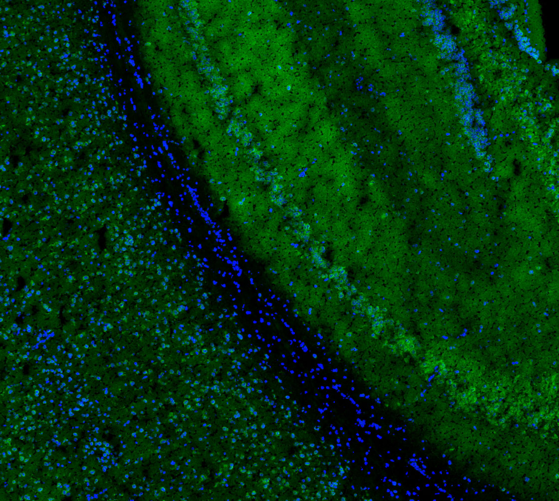 F1952-IF-Mouse-Brain