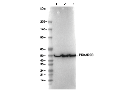 PRKAR2B Antibody [L21D1] WB