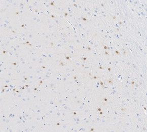 F2094-IHC1