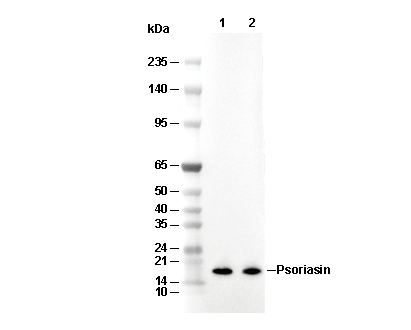 Psoriasin Antibody [L12L3] WB
