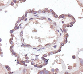 F2130-IHC1