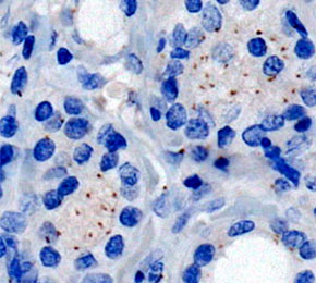F2239-IHC1