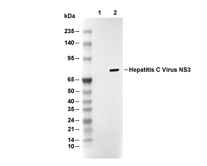 Hepatitis C Virus NS3 Antibody [N19B24] WB