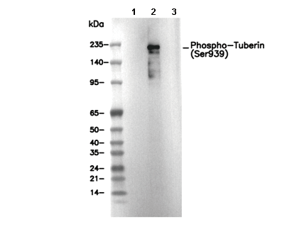Phospho-Tuberin (Ser939) Antibody [B6P7] WB