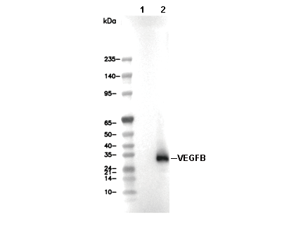 VEGFB Antibody [E11E24] WB