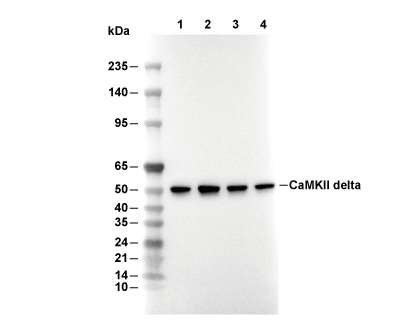 CaMKII&delta; Antibody [E8P2] WB