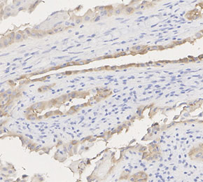 F2455-IHC1