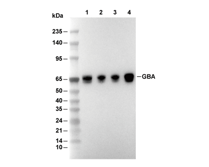 GBA Antibody [K1P17] WB