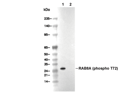 Phospho-RAB8A (Thr72) Antibody [A18L3] WB