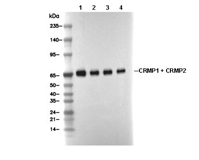 CRMP1 + CRMP2 Antibody [P10G14] WB