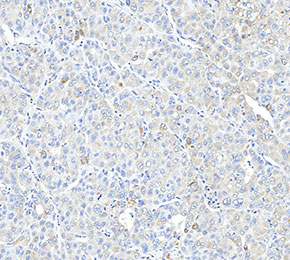 F2579-IHC1