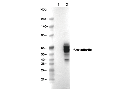 Synaptotagmin1 Antibody [K23K15] WB