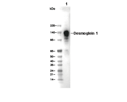 Desmoglein 1 Antibody [L24P16] WB