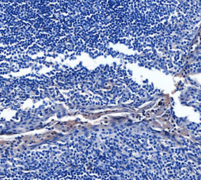 F2697-IHC1