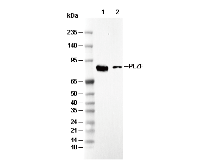 PLZF Antibody [J16B8] WB