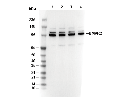 BMPR2 Antibody [P22A5] WB