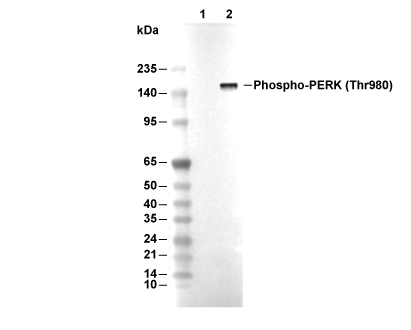 Phospho-PERK (Thr980) Antibody [E9N5] WB