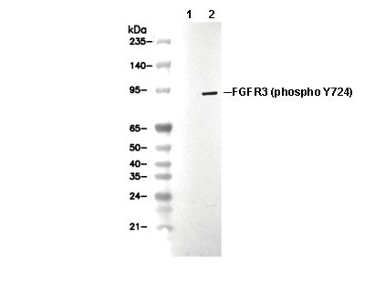 Phospho-FGFR3 (Tyr724) Antibody [K24F17] WB
