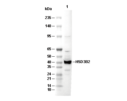 HSD3B2 Antibody [J9K21] WB