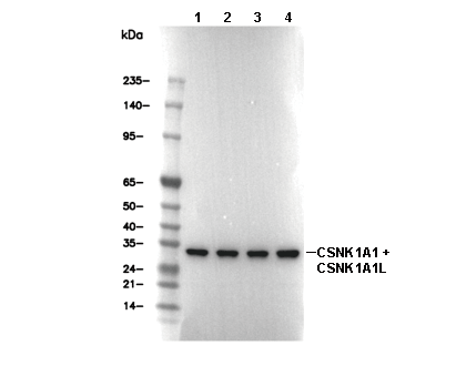 CSNK1A1 + CSNK1A1L Antibody [M11N18] WB