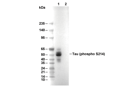 Phospho-Tau (Ser214) Antibody [M8H2] WB