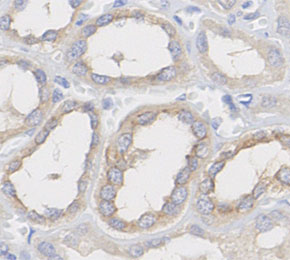 F2786-IHC1