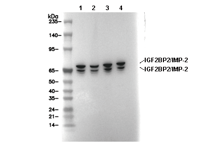 IGF2BP2/IMP-2 Antibody [H6A9] WB