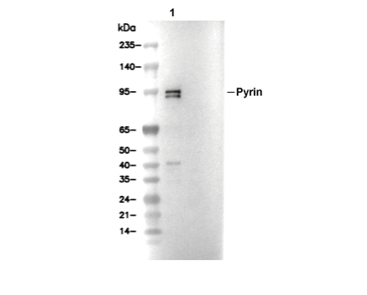 Pyrin Antibody [L17B15] WB