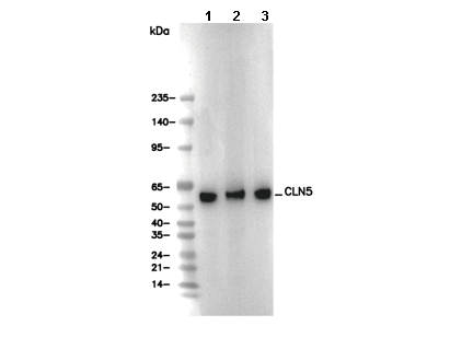 CLN5 Antibody [P4P21] WB
