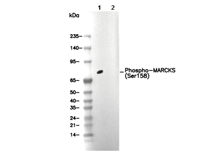 Phospho-MARCKS (Ser158) Antibody [D19L10] WB