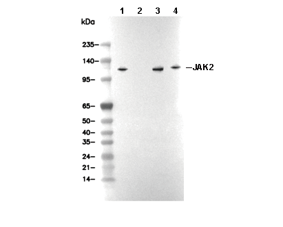 JAK2 Antibody [J11G12] WB