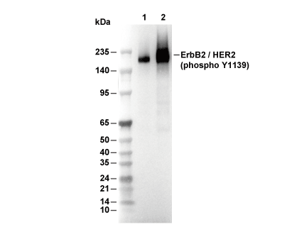 Phospho-HER2/ErbB2 (Tyr1139) Antibody [L15E14] WB