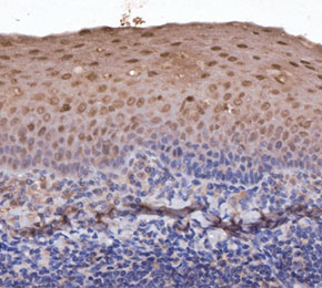 F2919-IHC1