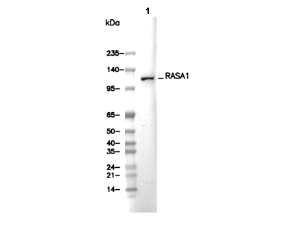 RASA1 Antibody [B14F6] WB