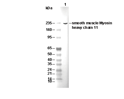 smooth muscle Myosin heavy chain 11 Antibody [J22F5] WB