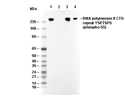 Phospho-RNA Pol II CTD (Ser5) Antibody [E1J24] WB