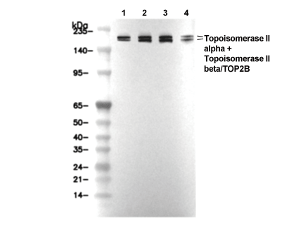 Topoisomerase II &alpha;+&beta; Antibody [L11B23] WB