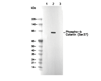 Phospho-&beta; Catenin (Ser37) Antibody [H12E11] WB