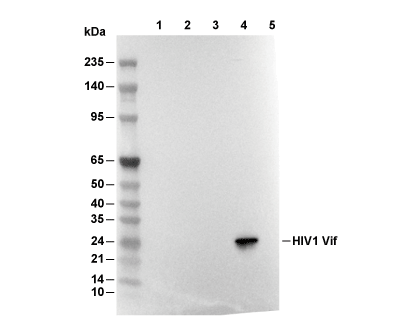 HIV1 Vif Antibody [P7N1] WB