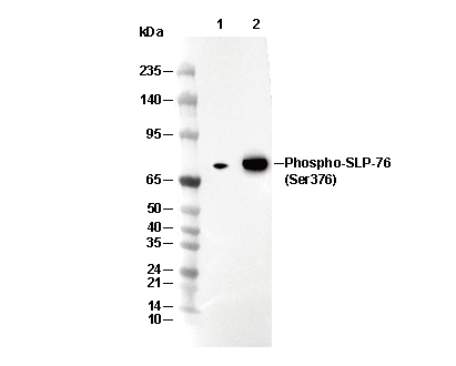 Phospho-SLP-76 (Ser376) Antibody [K18E5] WB