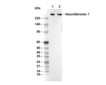 Neurofibromin 1 Antibody [J9P10] WB