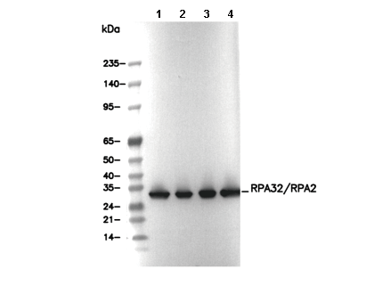 RPA32/RPA2 Antibody [G7F24] WB