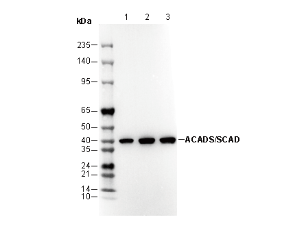 ACADS / SCAD Antibody [E23A17] WB