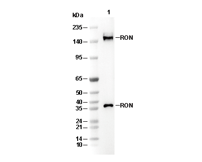 RON Antibody [M20B11] WB