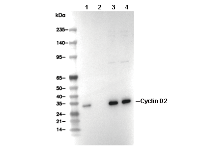 Cyclin D2 Antibody [F5H24] WB