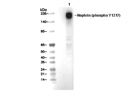 Phospho-Nephrin (Tyr1217) Antibody [L5D2] WB