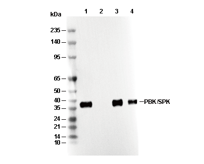 PBK/SPK Antibody [L14M16] WB