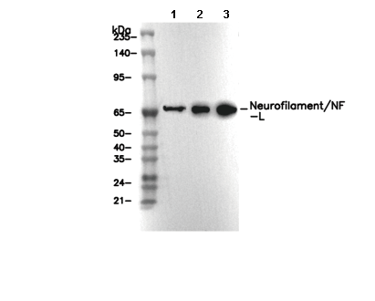Neurofilament/NF-L Antibody [E23C13] WB