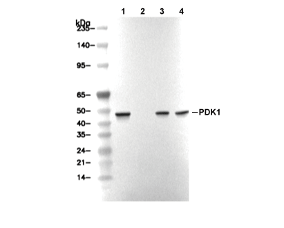 PDK1 Antibody [E12L3] WB